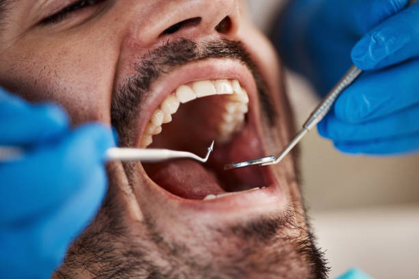 Best Emergency Cosmetic Dentistry (e.g., broken veneers) in Dresden, OH
